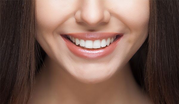 5 Ways To Prep Your Lips For That Perfect Pout