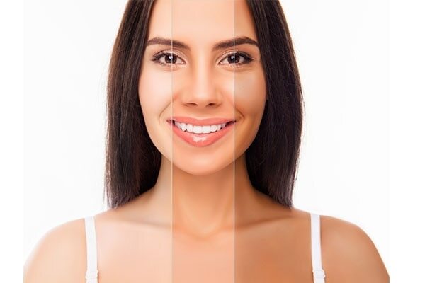 Cooler skin undertone