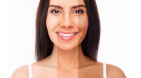 Cooler skin undertone