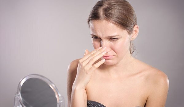 5 Simple Ways To Get Rid Of Blackheads...