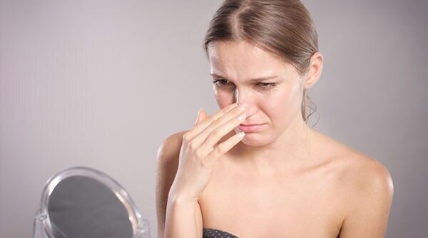 5 Simple Ways To Get Rid Of Blackheads...