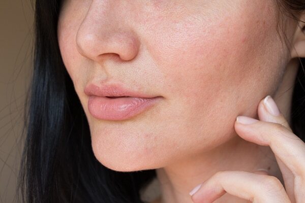 04. Premature signs of ageing