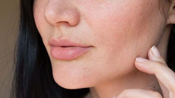 04. Premature signs of ageing