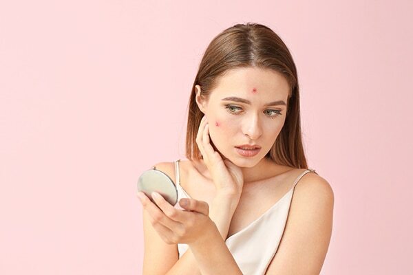 04. Premature signs of ageing