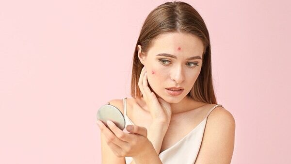04. Premature signs of ageing