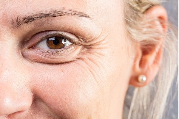 Sandalwood For Swelling