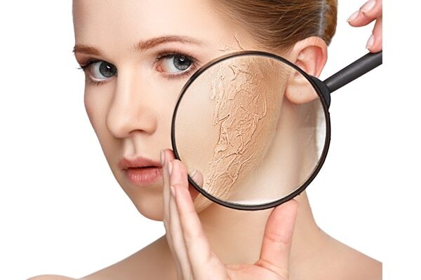 Sandalwood For Swelling