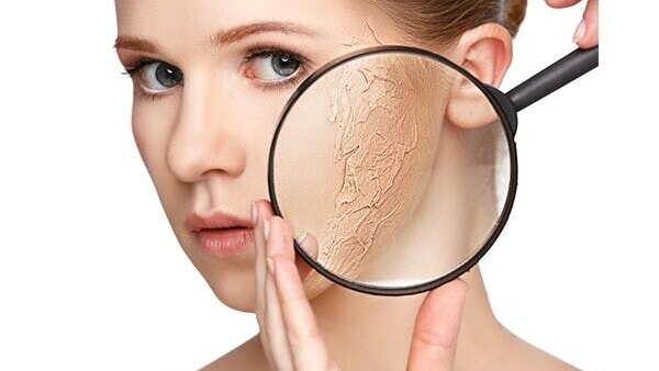 Sandalwood For Swelling