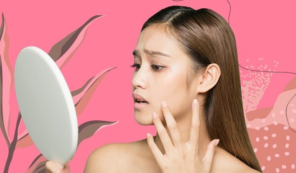 5 Surprising Reasons Why Your Skin Is Breaking Out