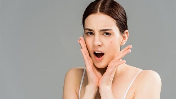 FAQs about the harmful effects of smoking