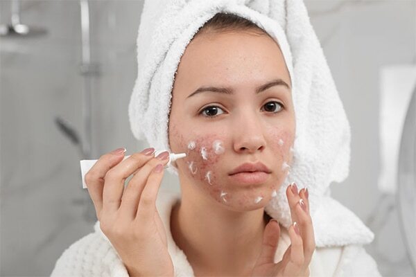 04. Use a retinoid
