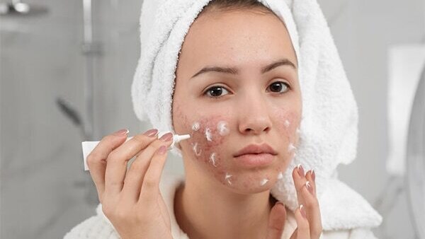 04. Use a retinoid