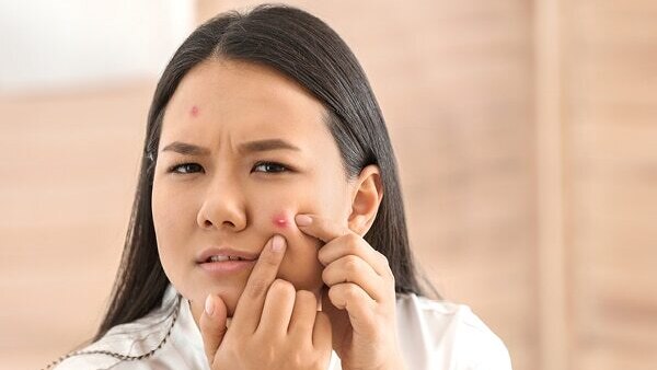 FAQs about gold facials