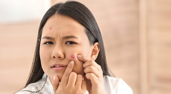 FAQs about gold facials