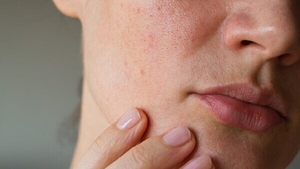Canola seeds benefits 12: Controls frizz