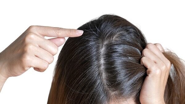 How to Consume Folic Acid for Hair?