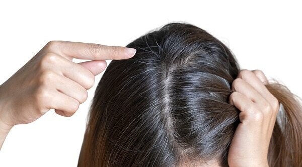 How to Consume Folic Acid for Hair?