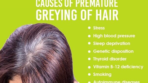 FAQs: Home remedies for white hair
