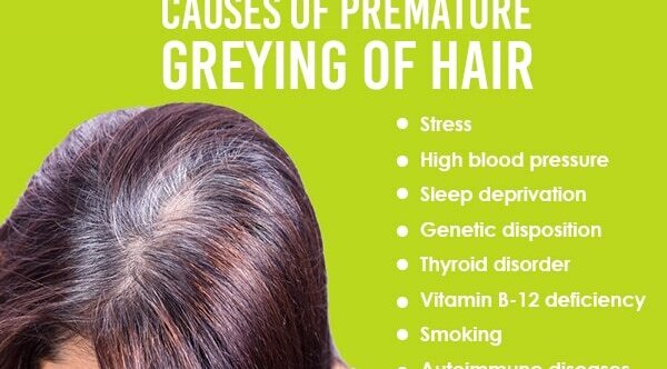 FAQs: Home remedies for white hair
