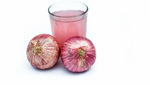 FAQs: Home remedies for white hair