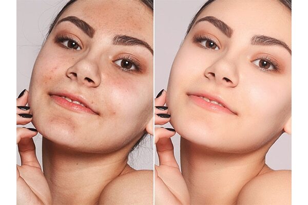 FAQs: Apple benefits for the skin