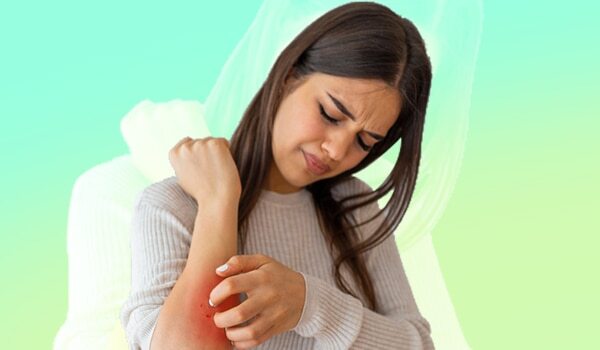 5 Essential Oils To HelpCalm Eczema