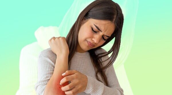 5 Essential Oils To HelpCalm Eczema