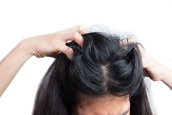 Treats hair fall