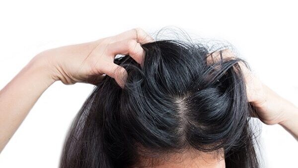 Treats hair fall