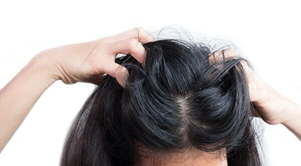 Treats hair fall