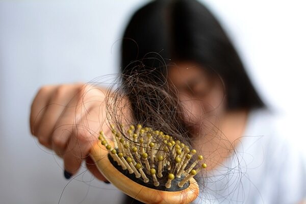 Treats hair fall