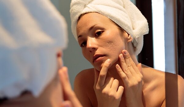 5 Effective Ways To Get Rid Of Facial Scars Once And For All