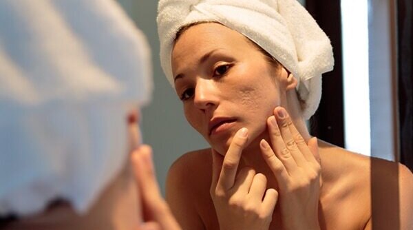5 Effective Ways To Get Rid Of Facial Scars Once And For All