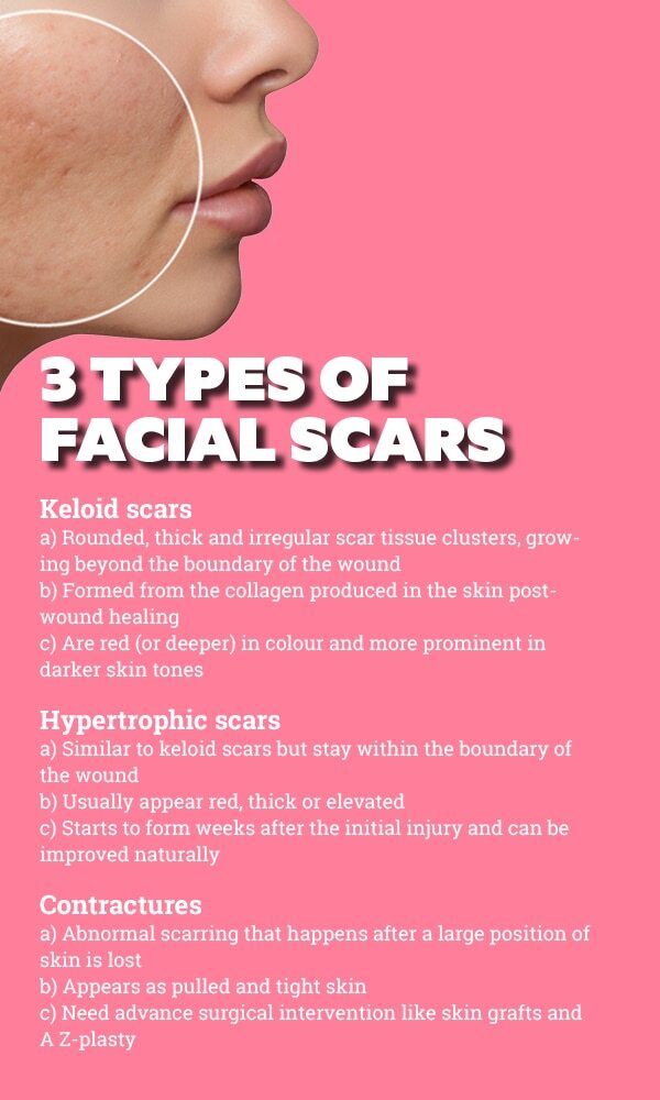 FAQs about facial scars