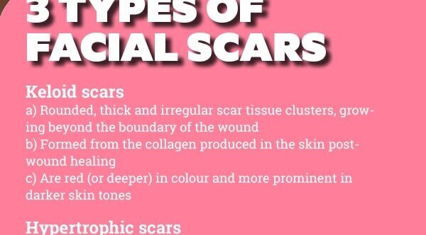 FAQs about facial scars