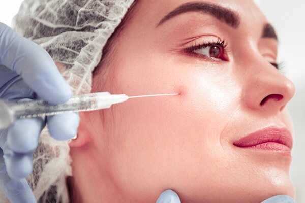 FAQs about facial scars