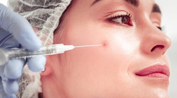 FAQs about facial scars
