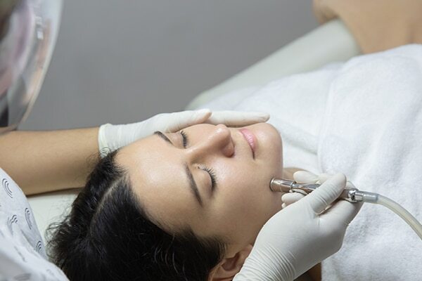 FAQs about facial scars