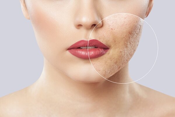 FAQs about facial scars