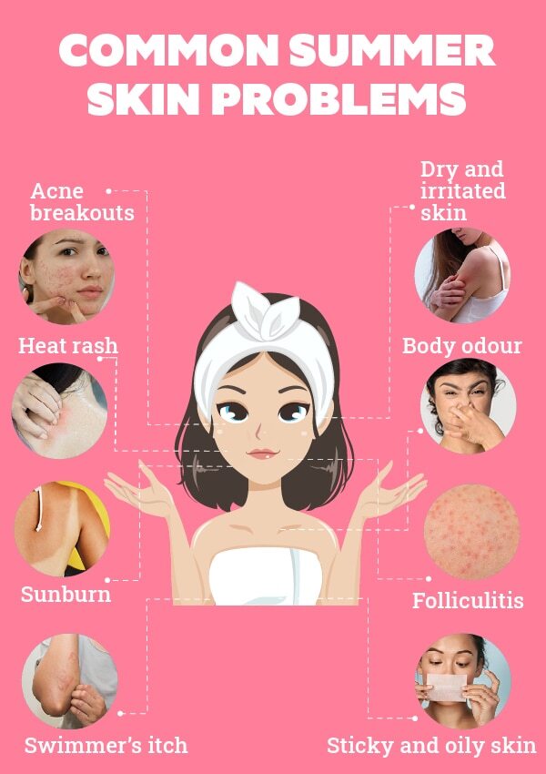 FAQs about summer skin problems