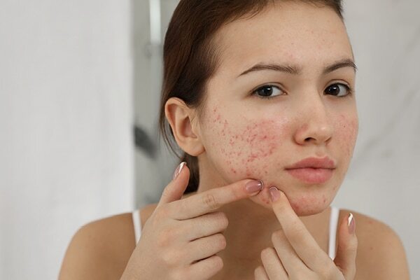 FAQs about summer skin problems