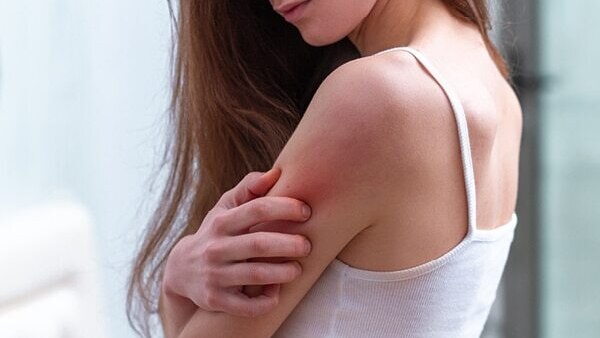 FAQs about summer skin problems