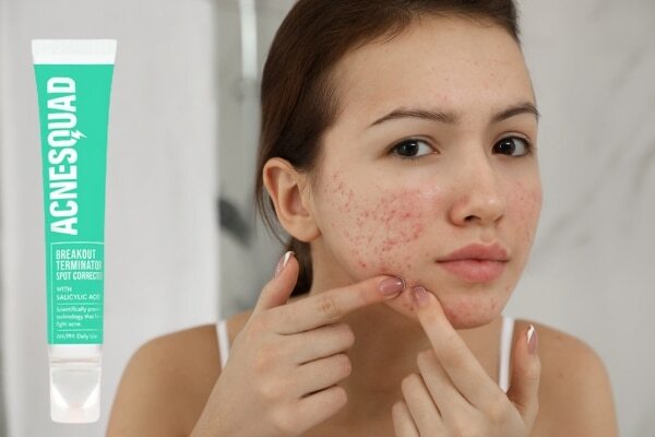 get-rid-of-pimples
