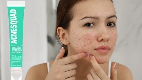 get-rid-of-pimples