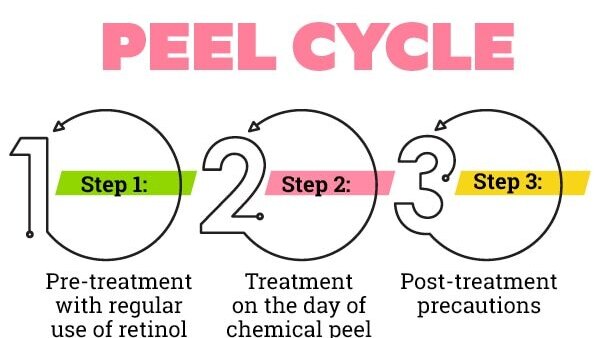 FAQs on chemical peels at home: