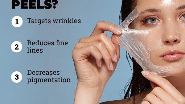 FAQs on chemical peels at home: