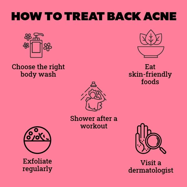 FAQs about back acne