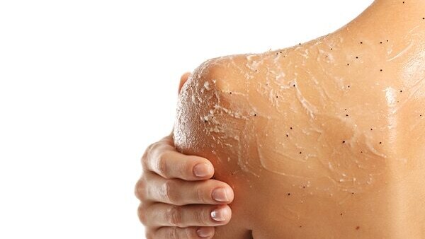 FAQs about back acne
