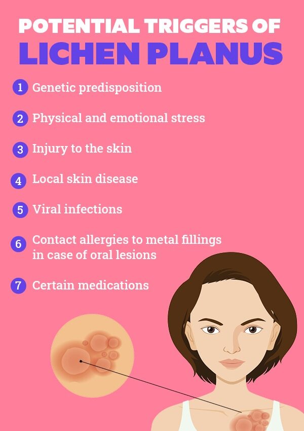 FAQs about lichen planus