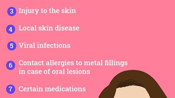 FAQs about lichen planus